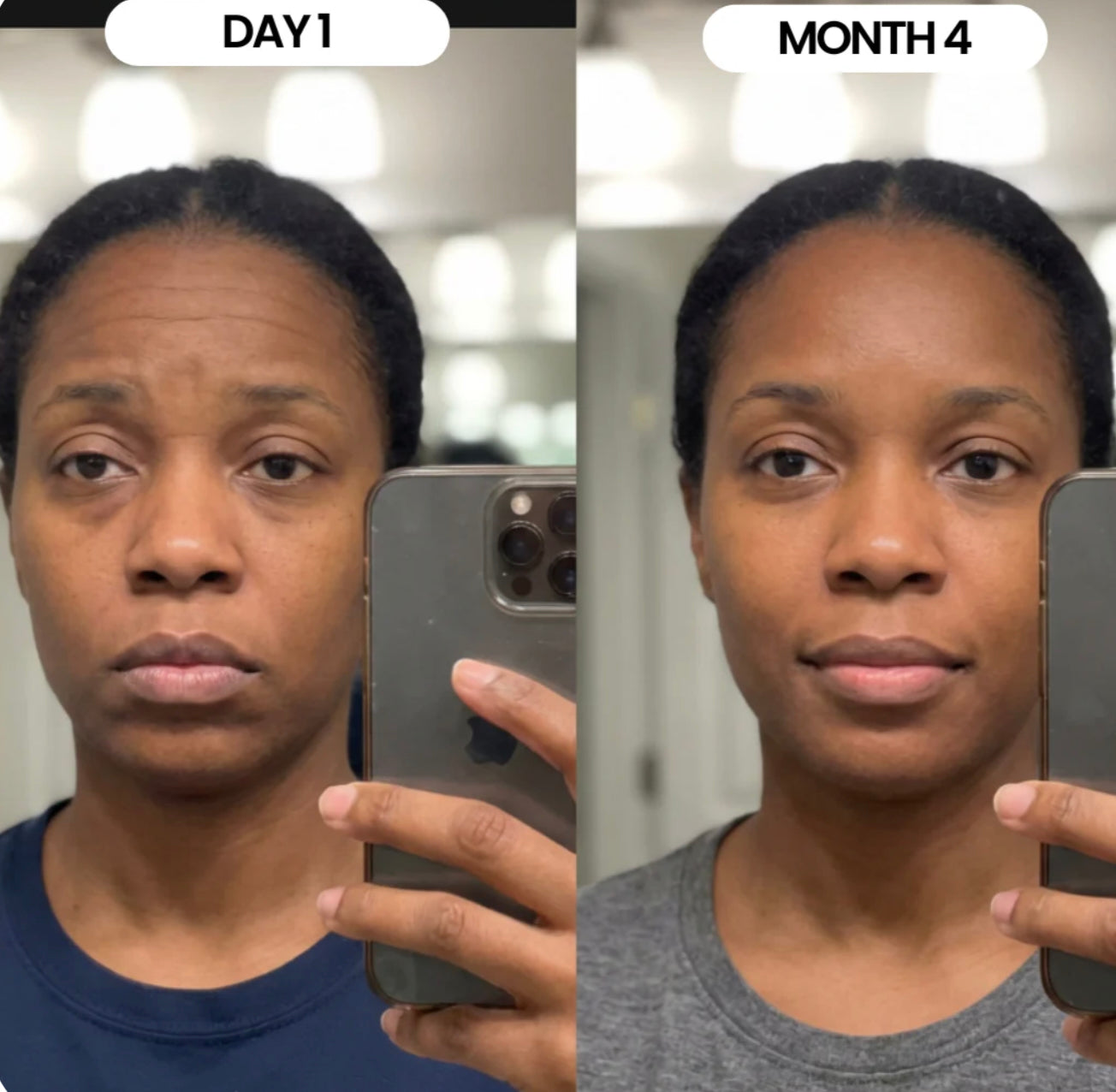 Calcium Multi Balm Stick™ | Smoother Skin. Fresh Glow. Visible Results – In Just One Swipe!